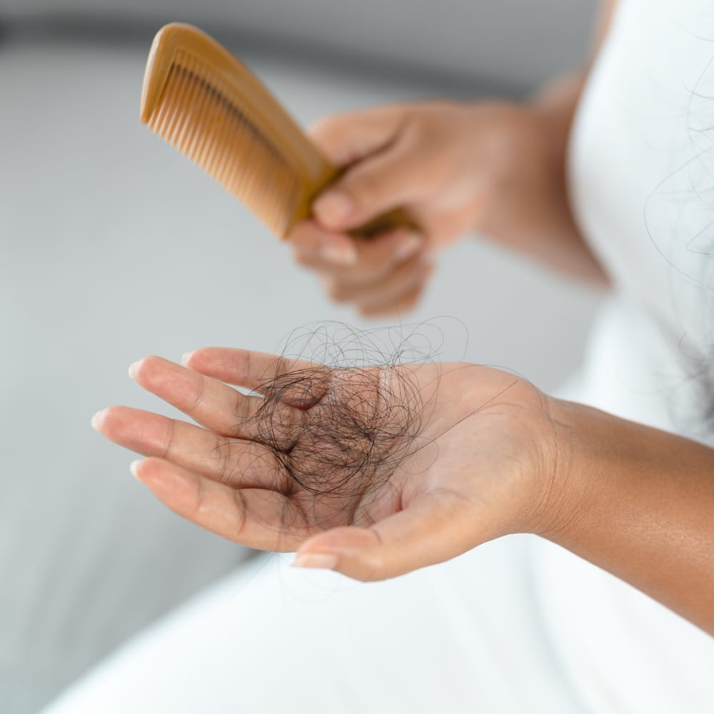 alopecia-areata-treatment