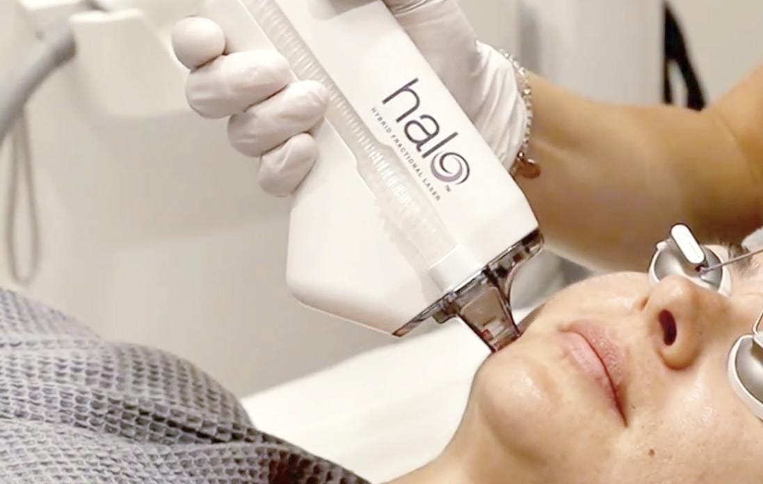 Halo® Laser