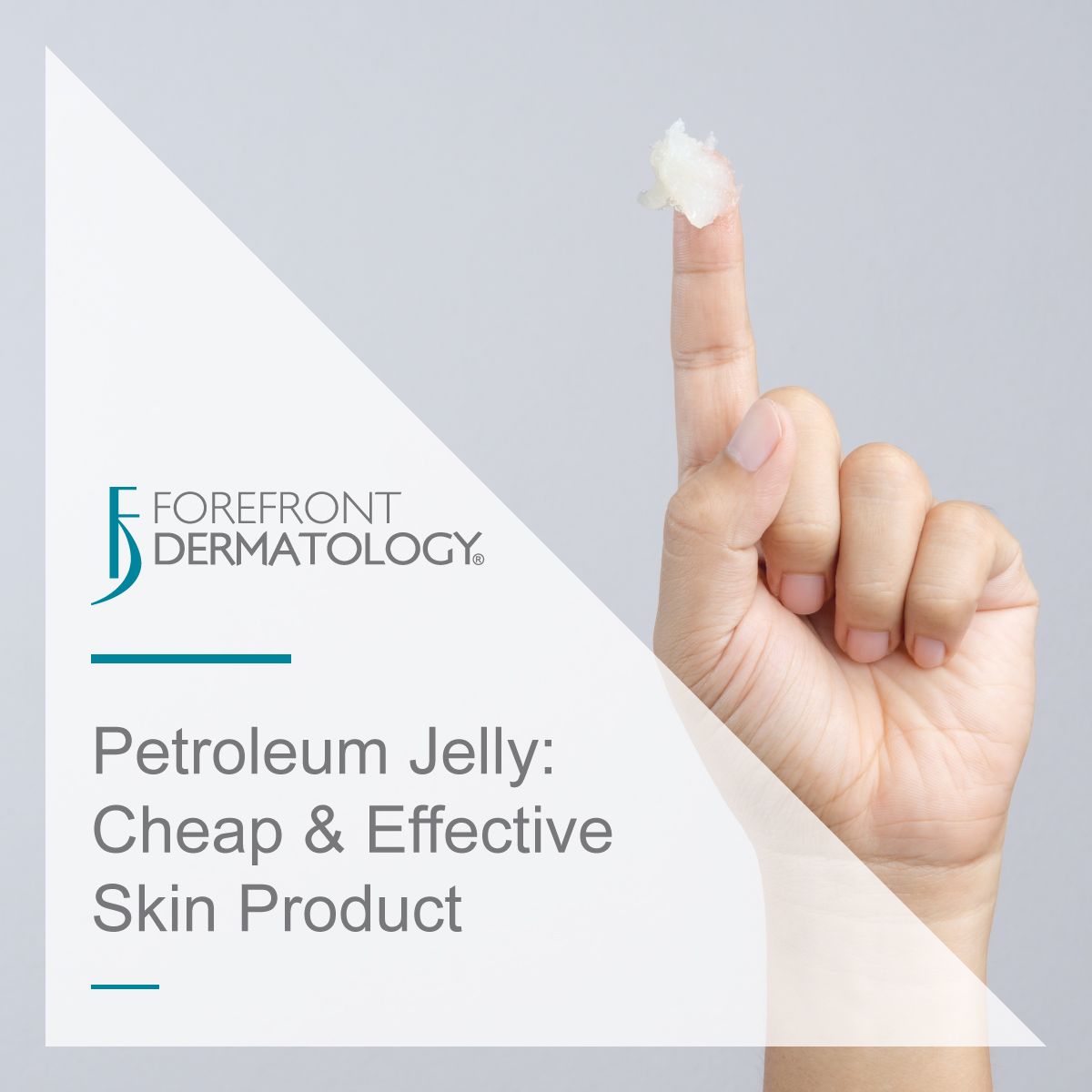 Petroleum jelly