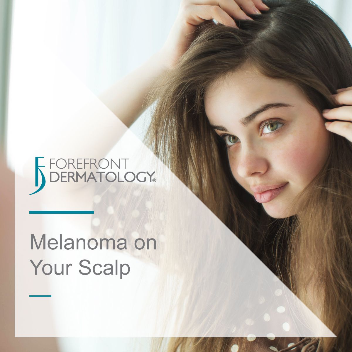 melanoma on scalp
