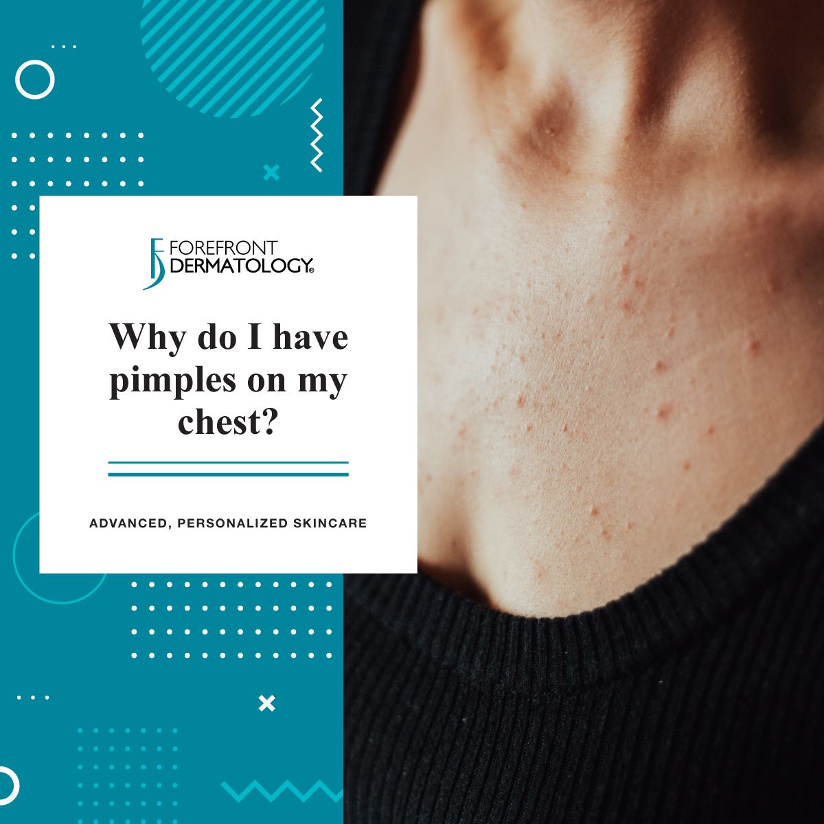 Why do I have pimples on my chest?
