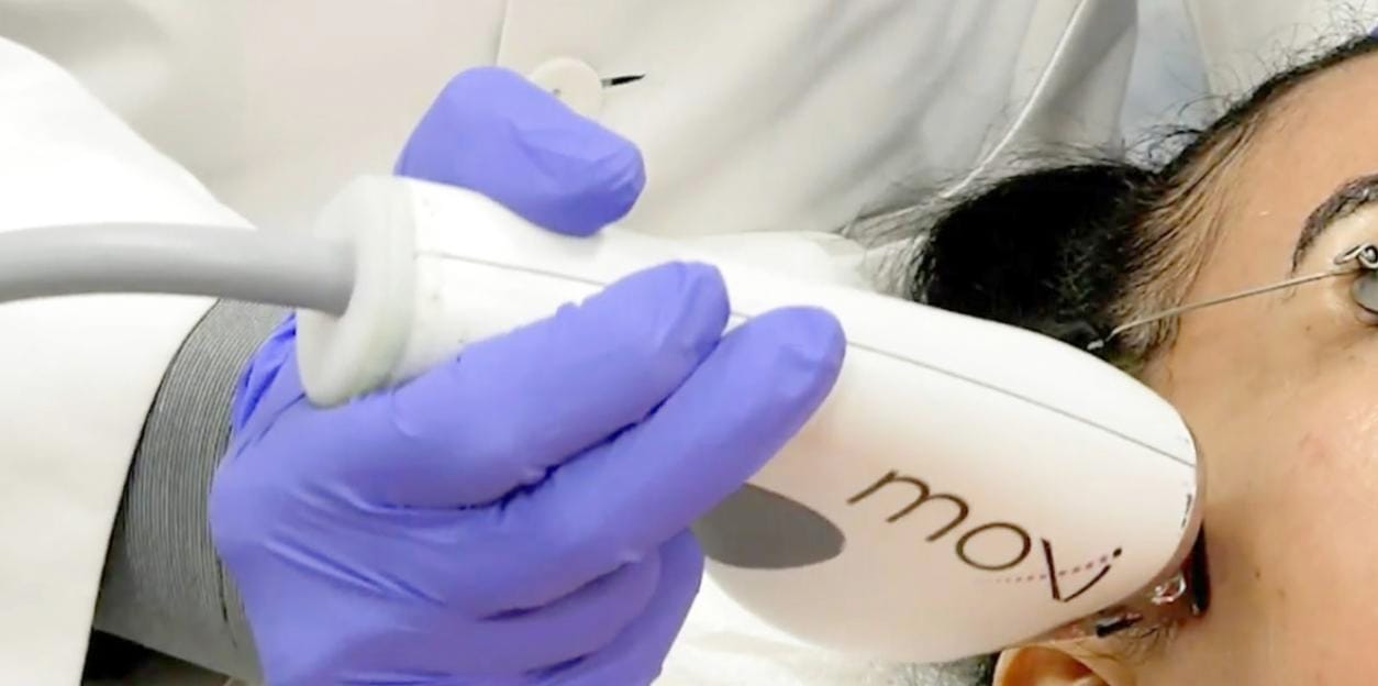 Sciton® MOXI™ Laser