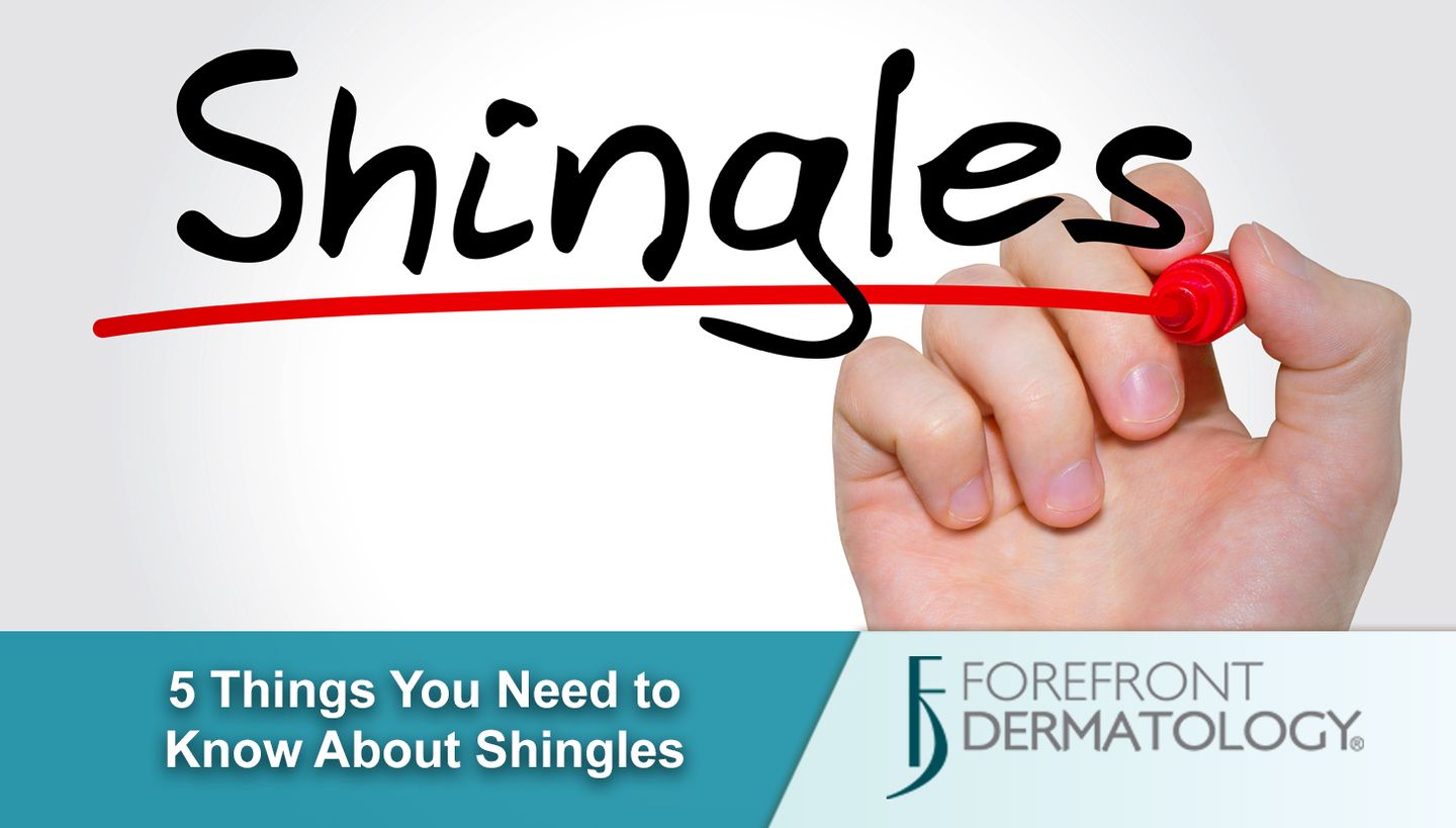 shingles