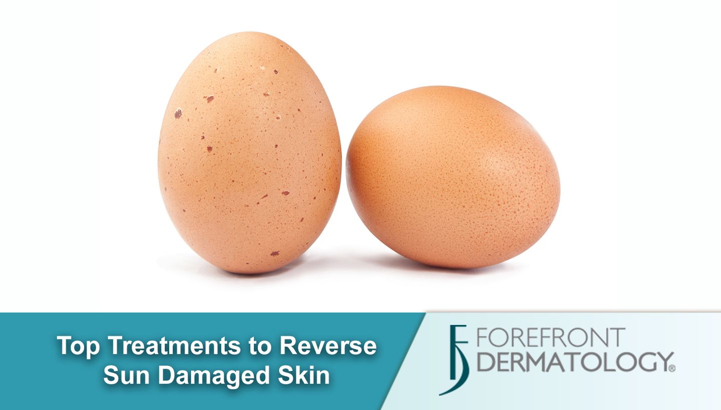 Reverse Sun Damaged Skin
