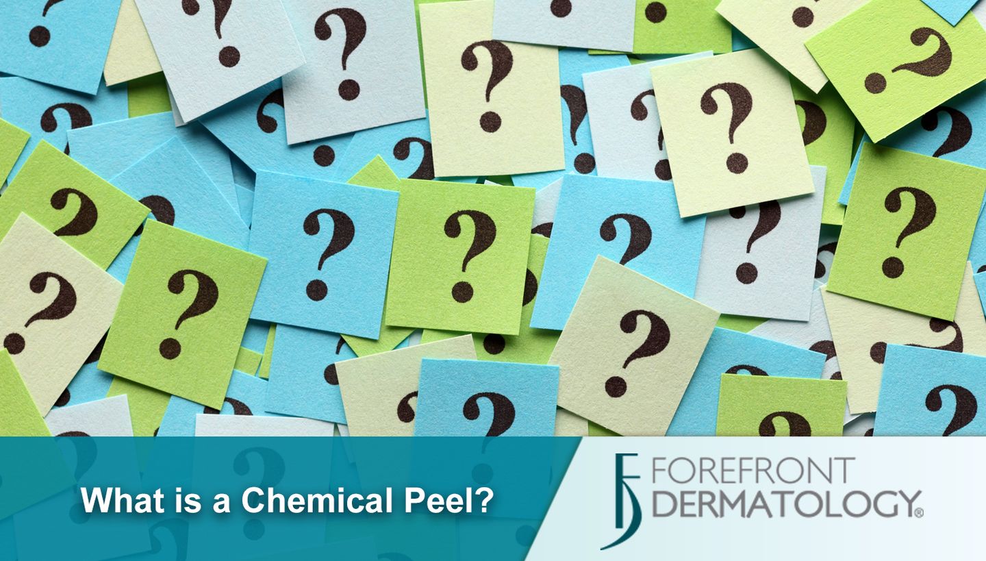 Chemical Peel