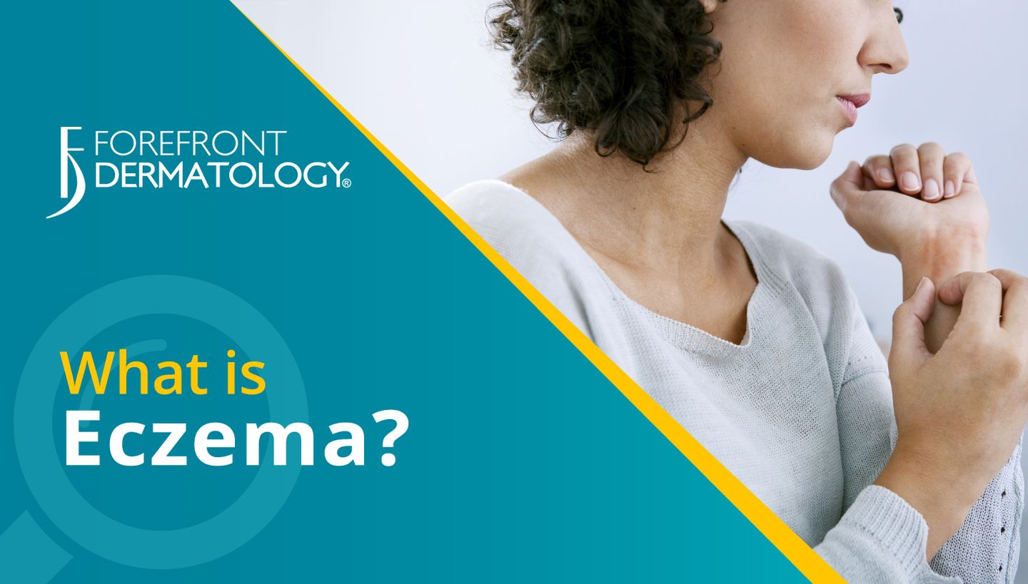 eczema