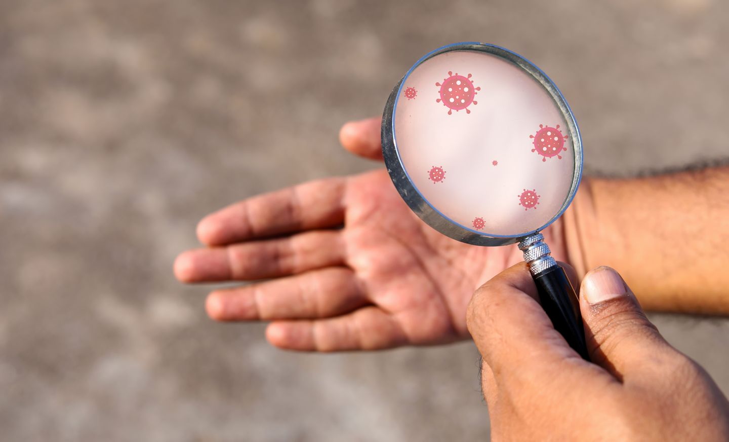 Man holding magnifying glass to check hands with eczema rash showing eczema microbiome