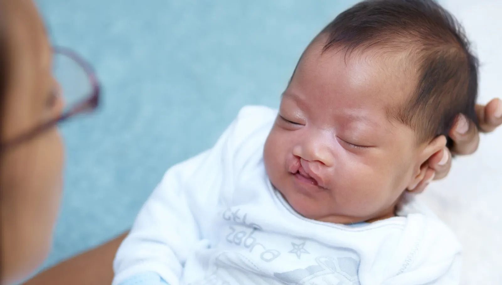 Cleft Lip and Palate Surgery