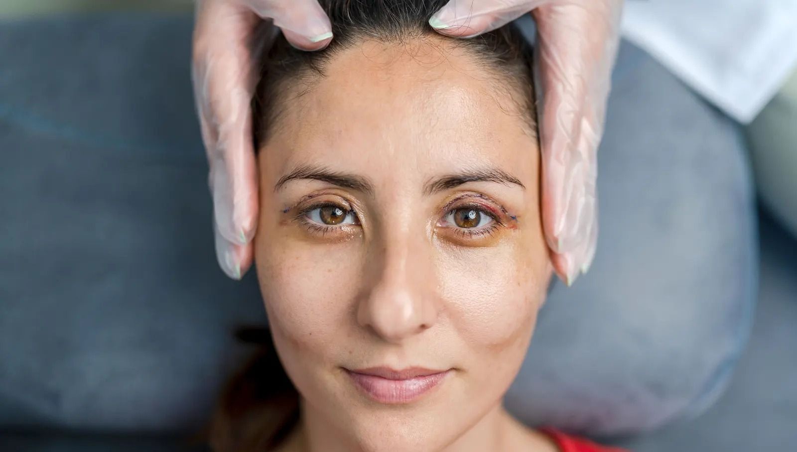 Face Surgery