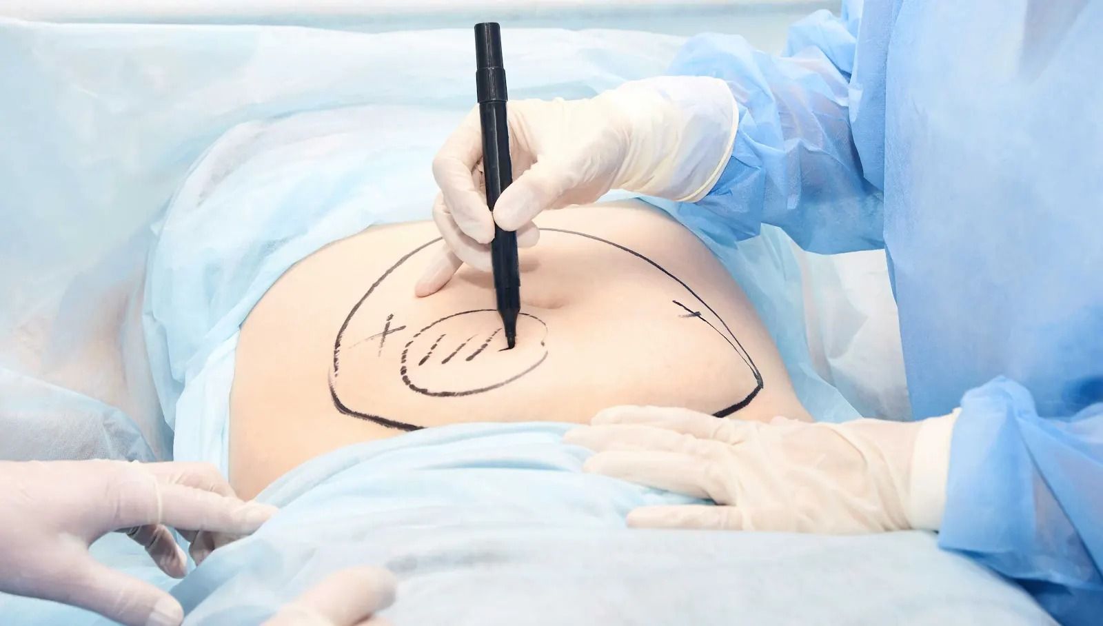 Surgery