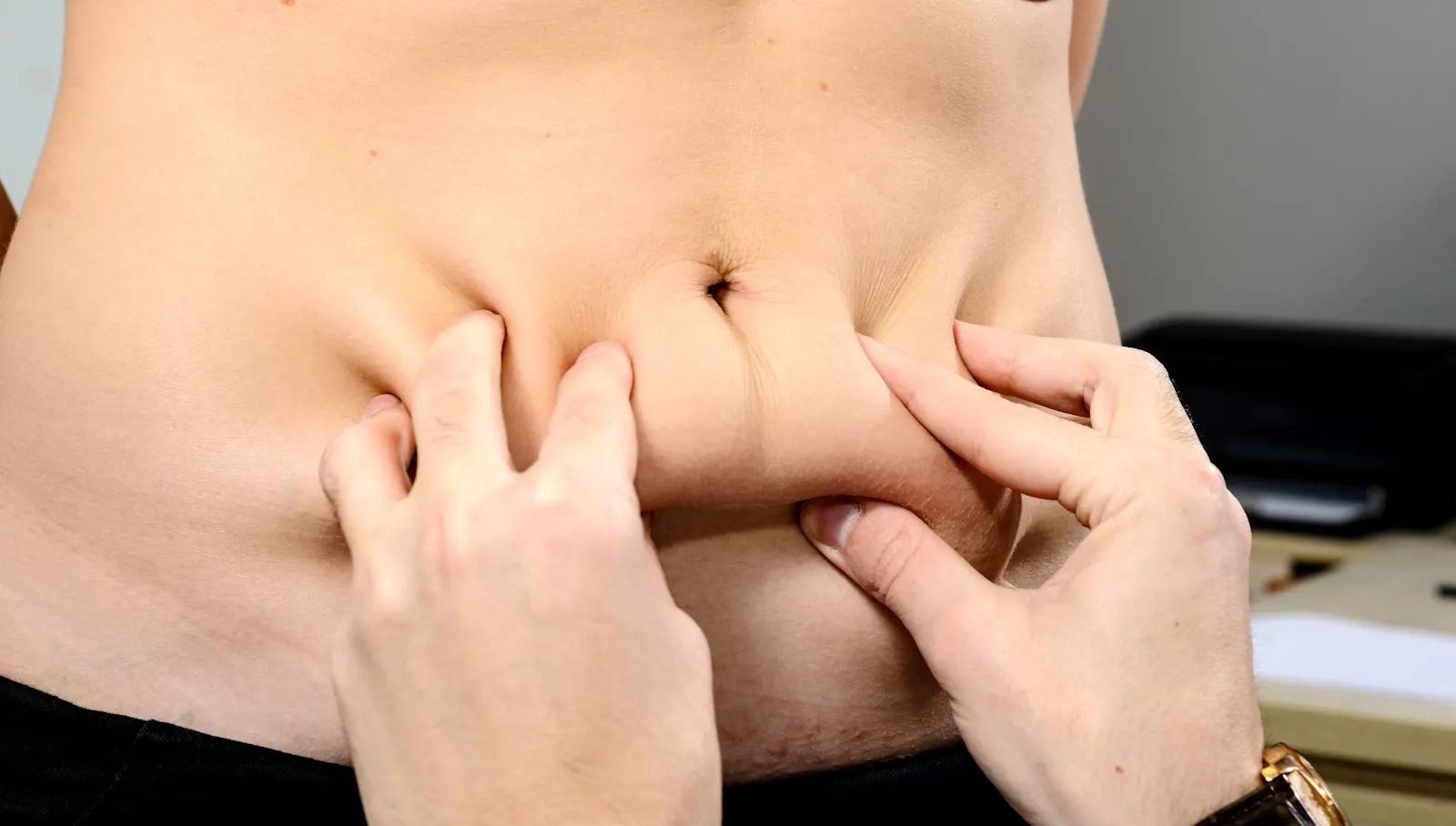 Tummy Tuck