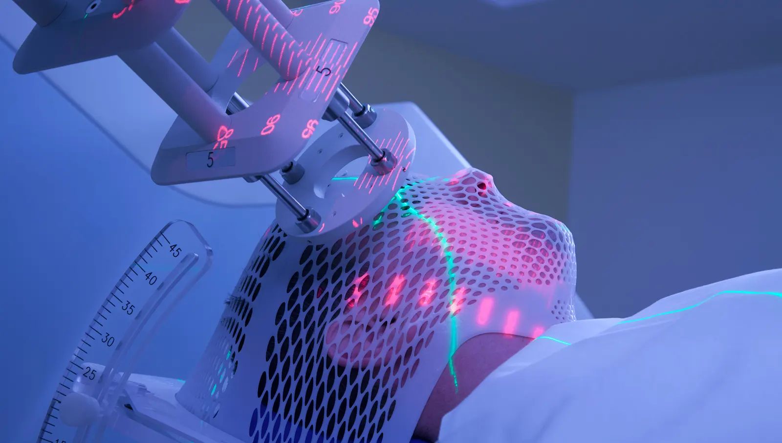 Electronic Skin Brachytherapy
