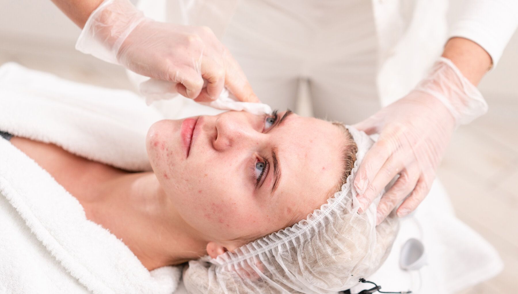 Clarifying Peel