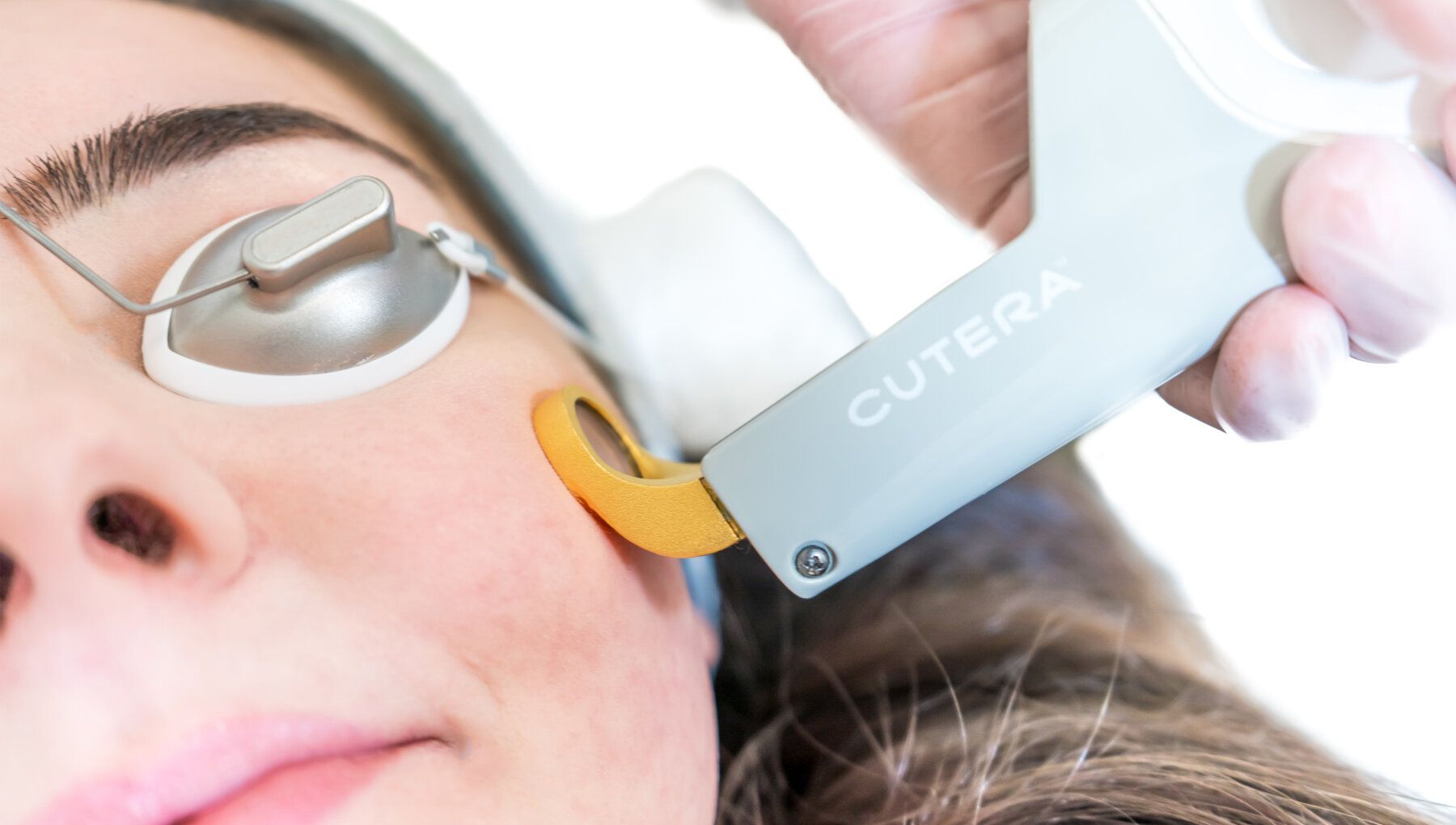 Cutera Titan Laser