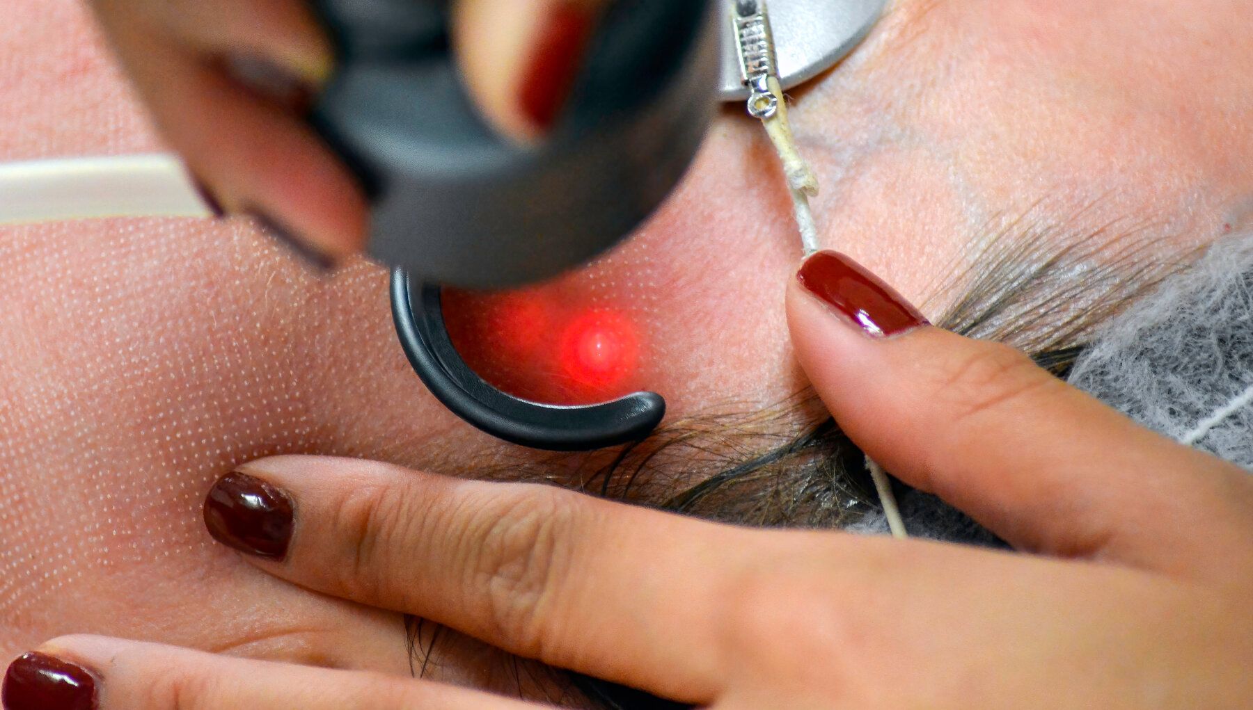 DOT Therapy