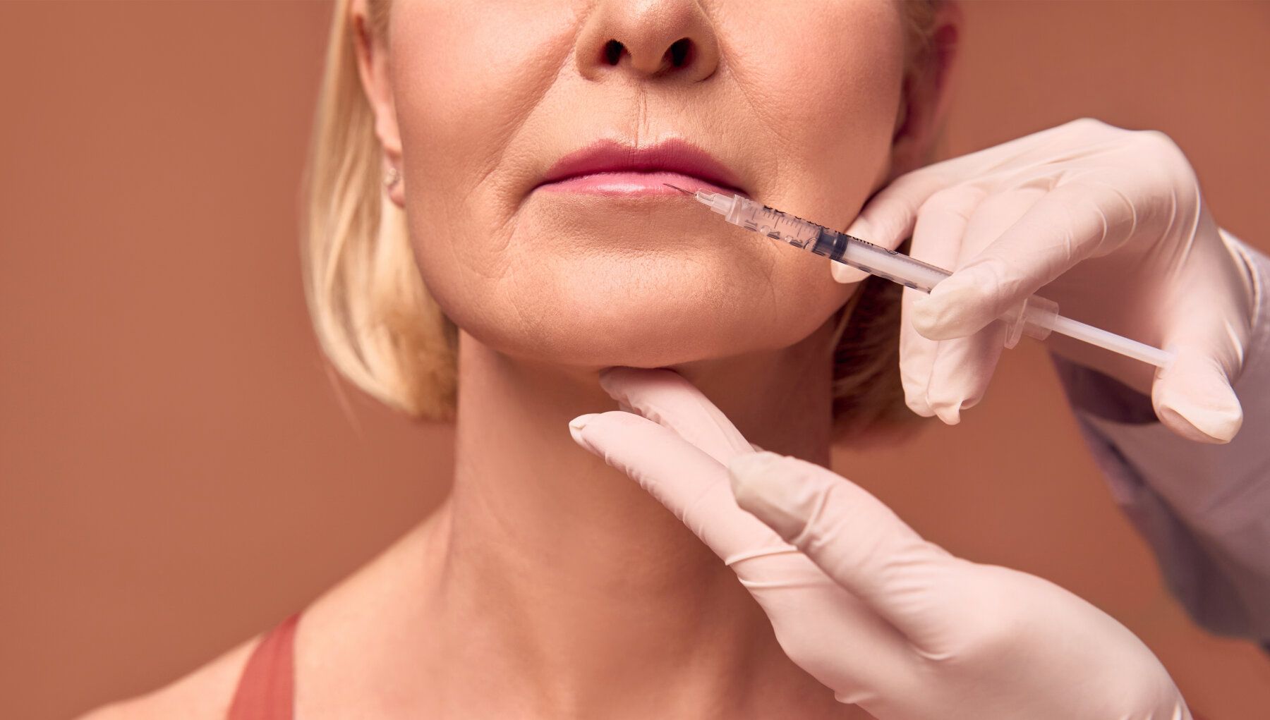 Dermal Fillers