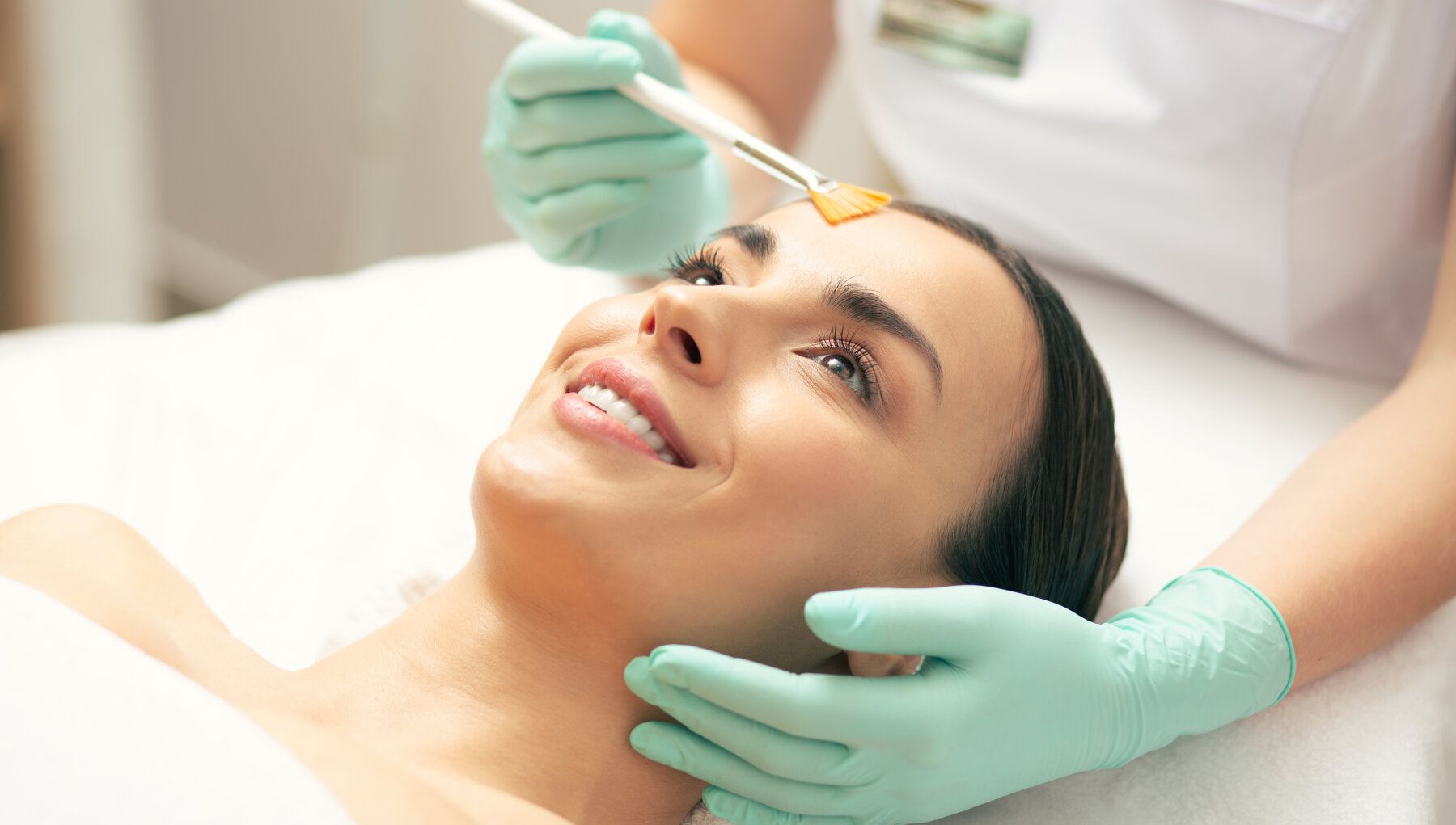 Melasma Peel