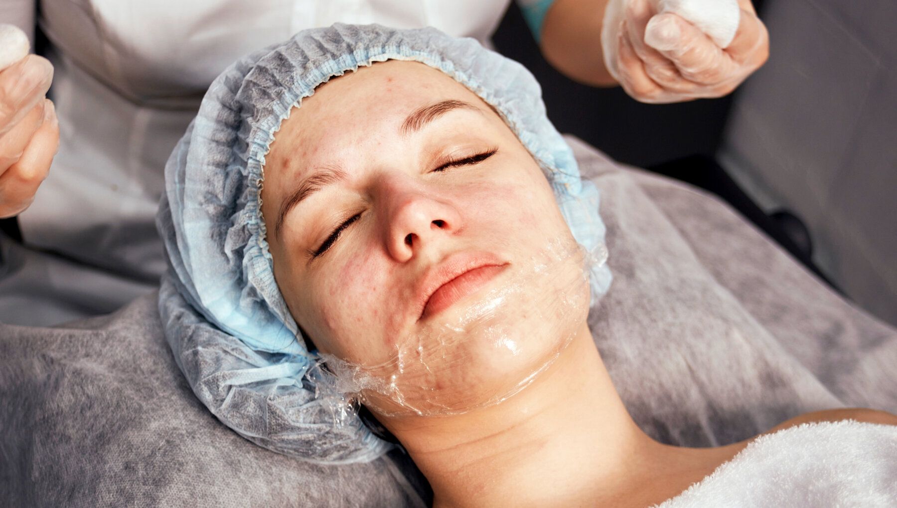Mini-Melanage Peel