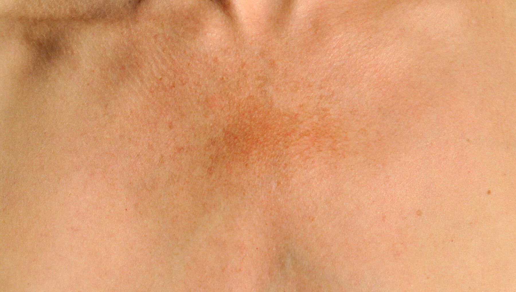 NEOCUTIS