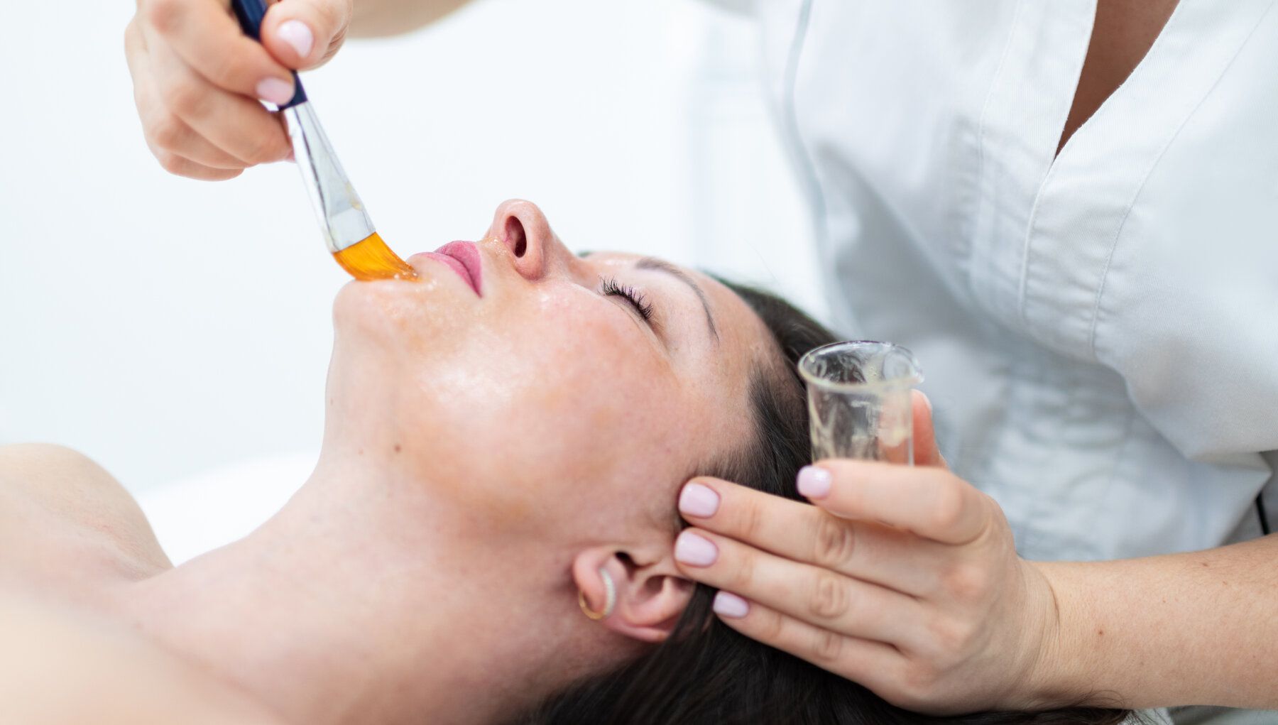 VI® Chemical Peel
