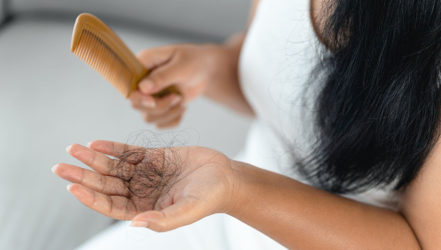Alopecia Areata (Hair Loss)
