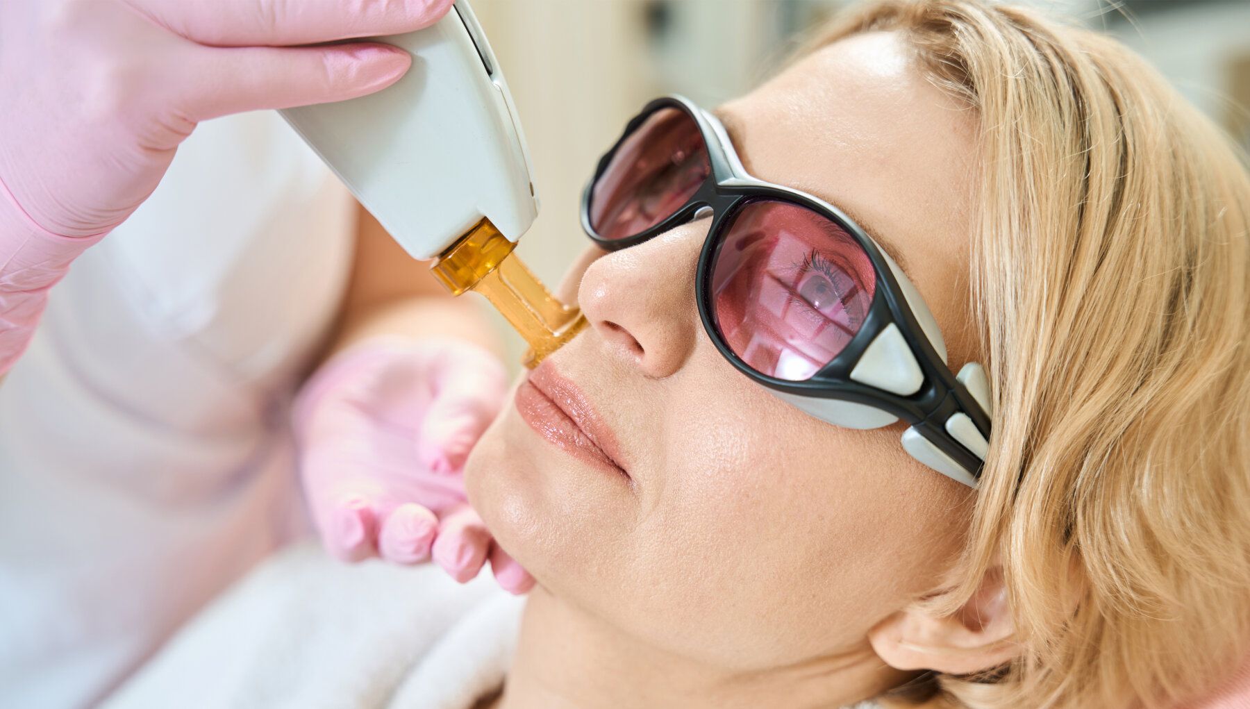 Candela CO2RE® Laser