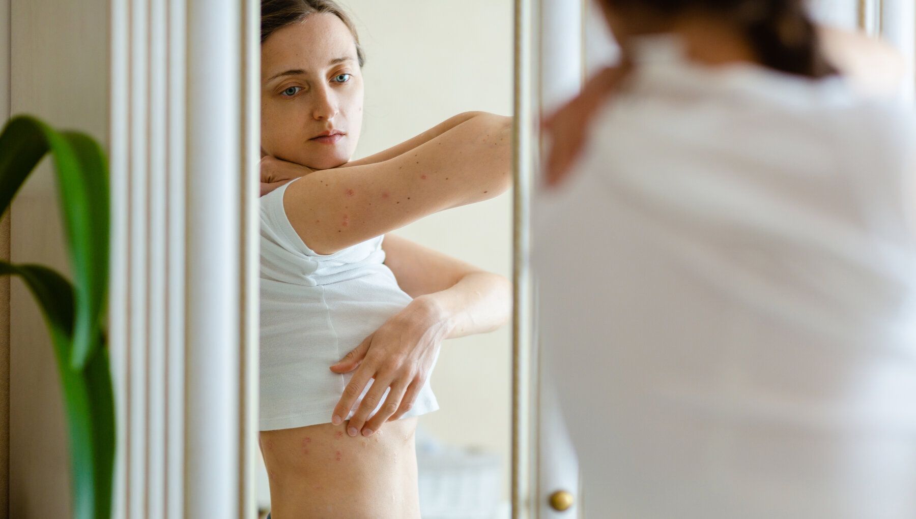 Contact Dermatitis