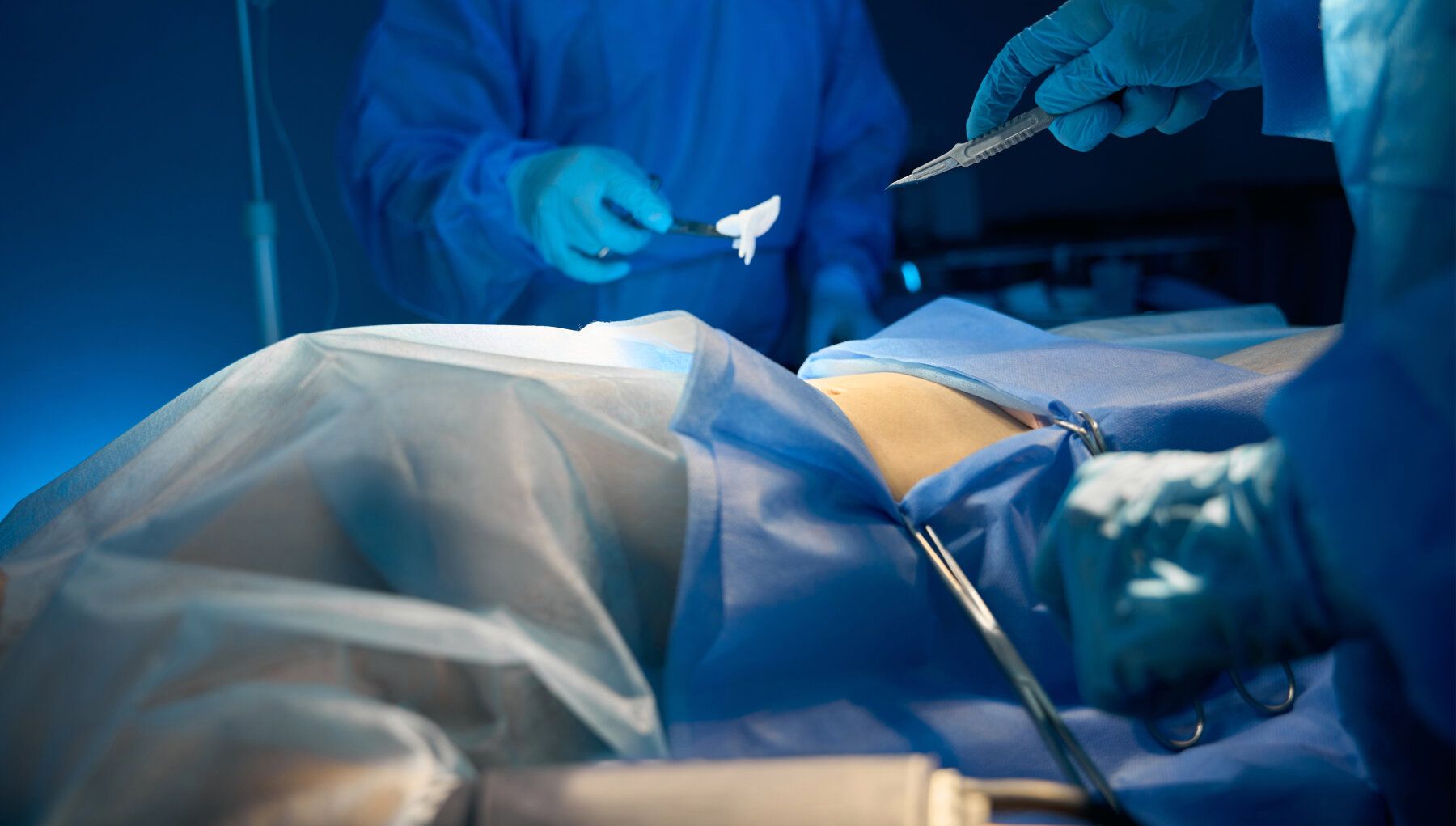Excisional Surgery
