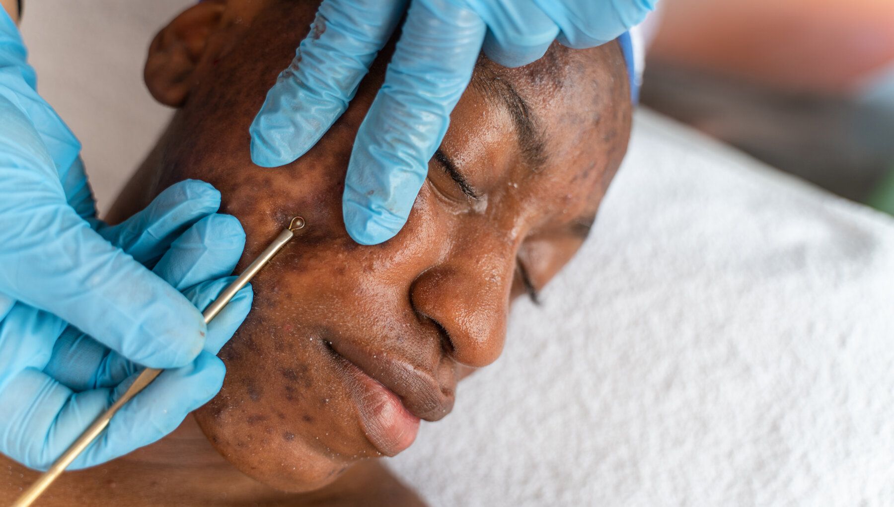 Extractions
