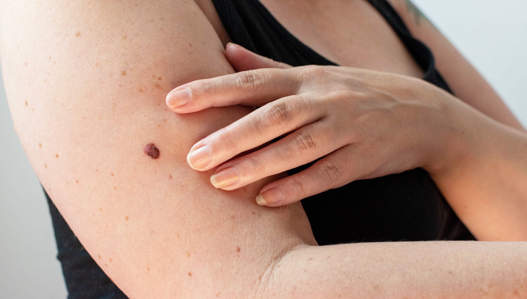 Moles