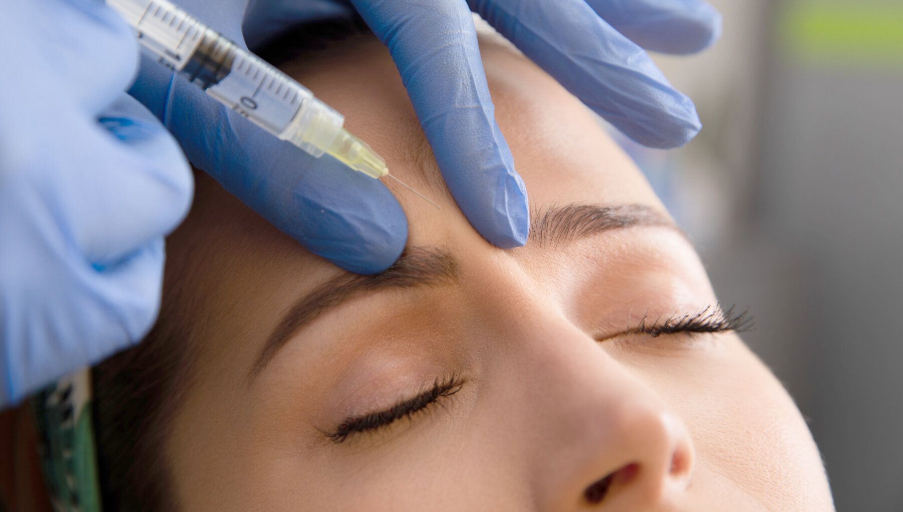 RHA Dermal Fillers