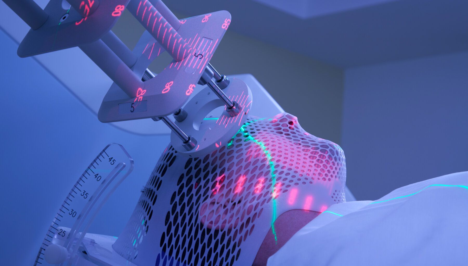 Superficial Radiation Therapy (SRT)