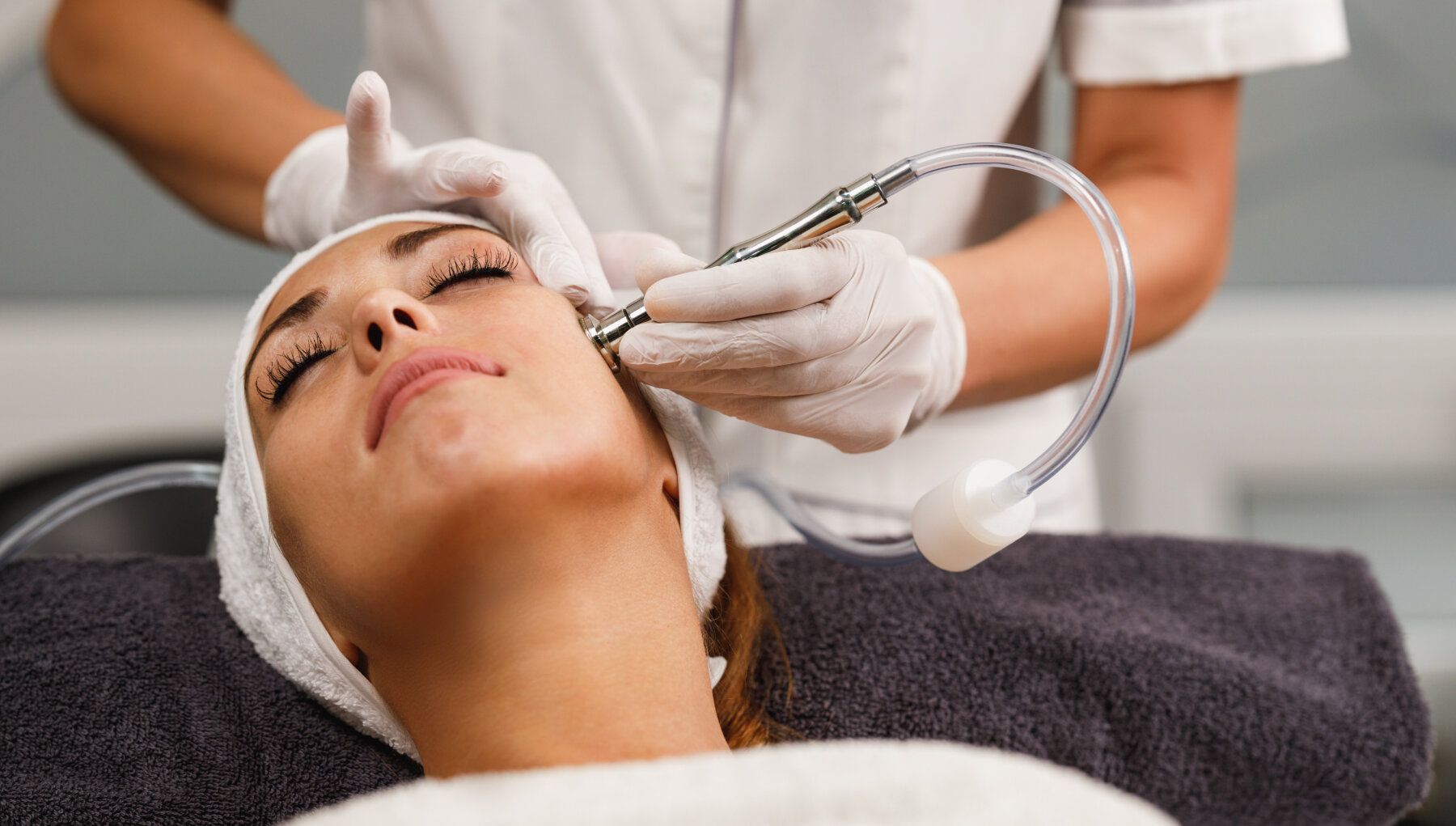 Microdermabrasion