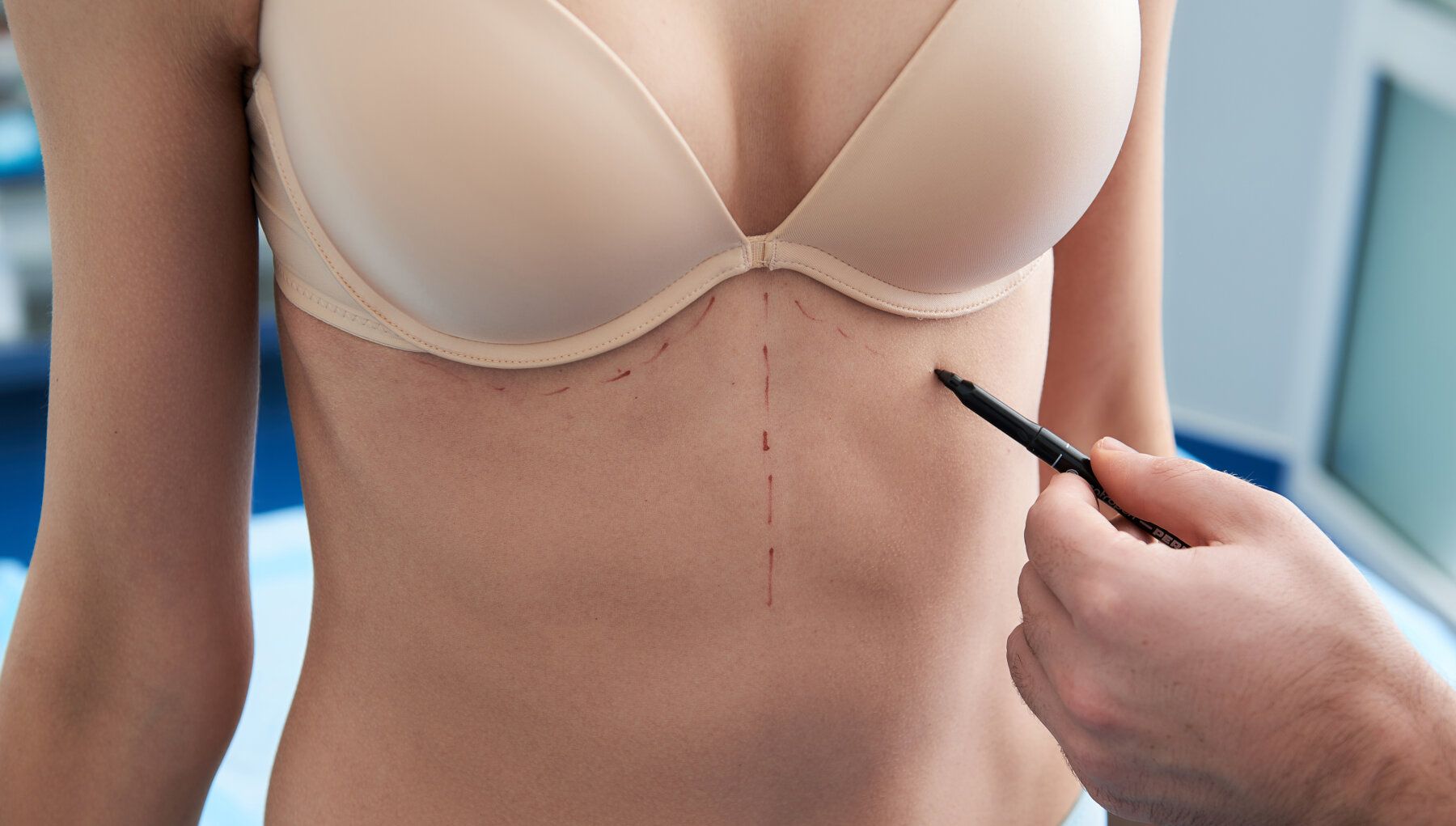 Breast revision surgery