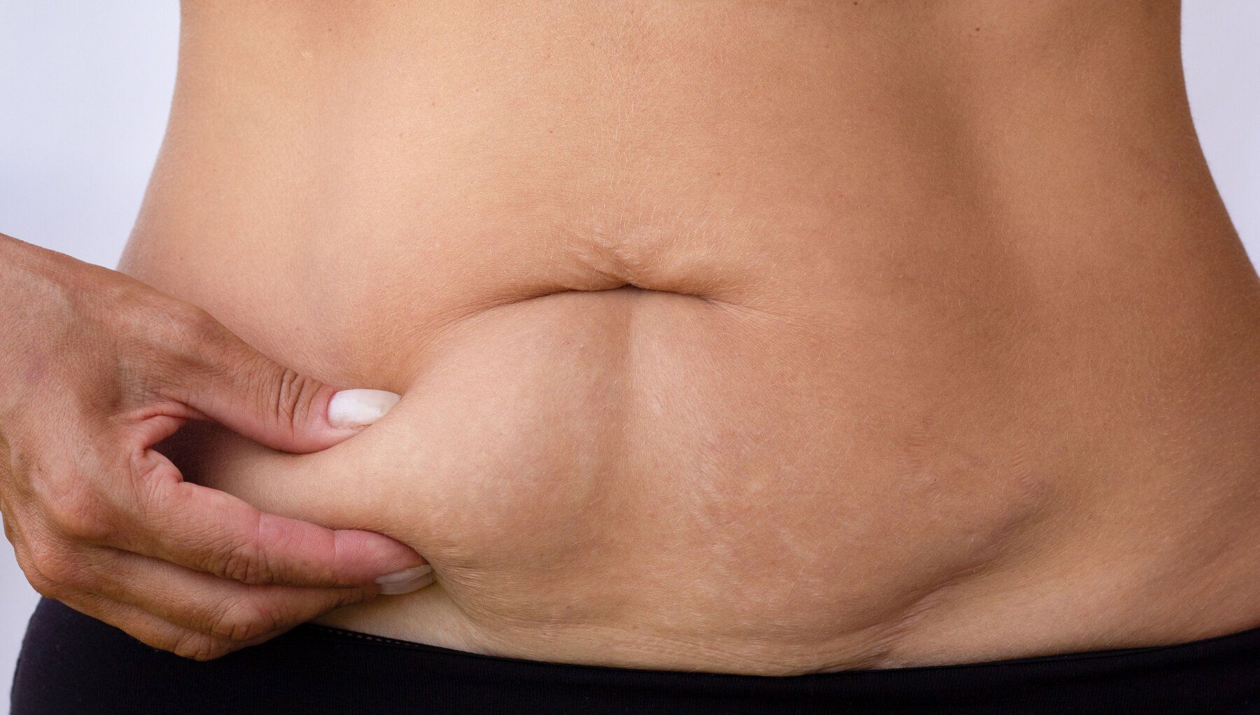 Thermi250® Skin Tightening