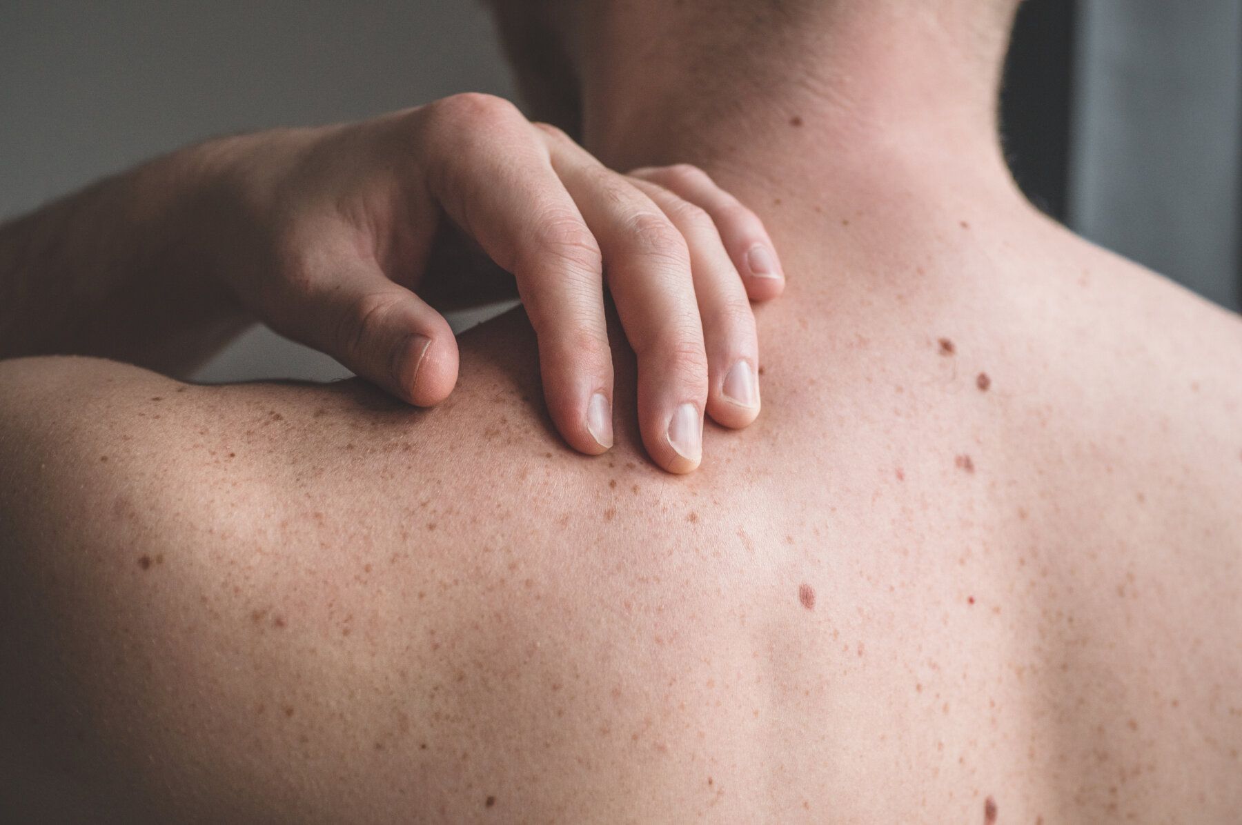 Skin Cancer Surgery