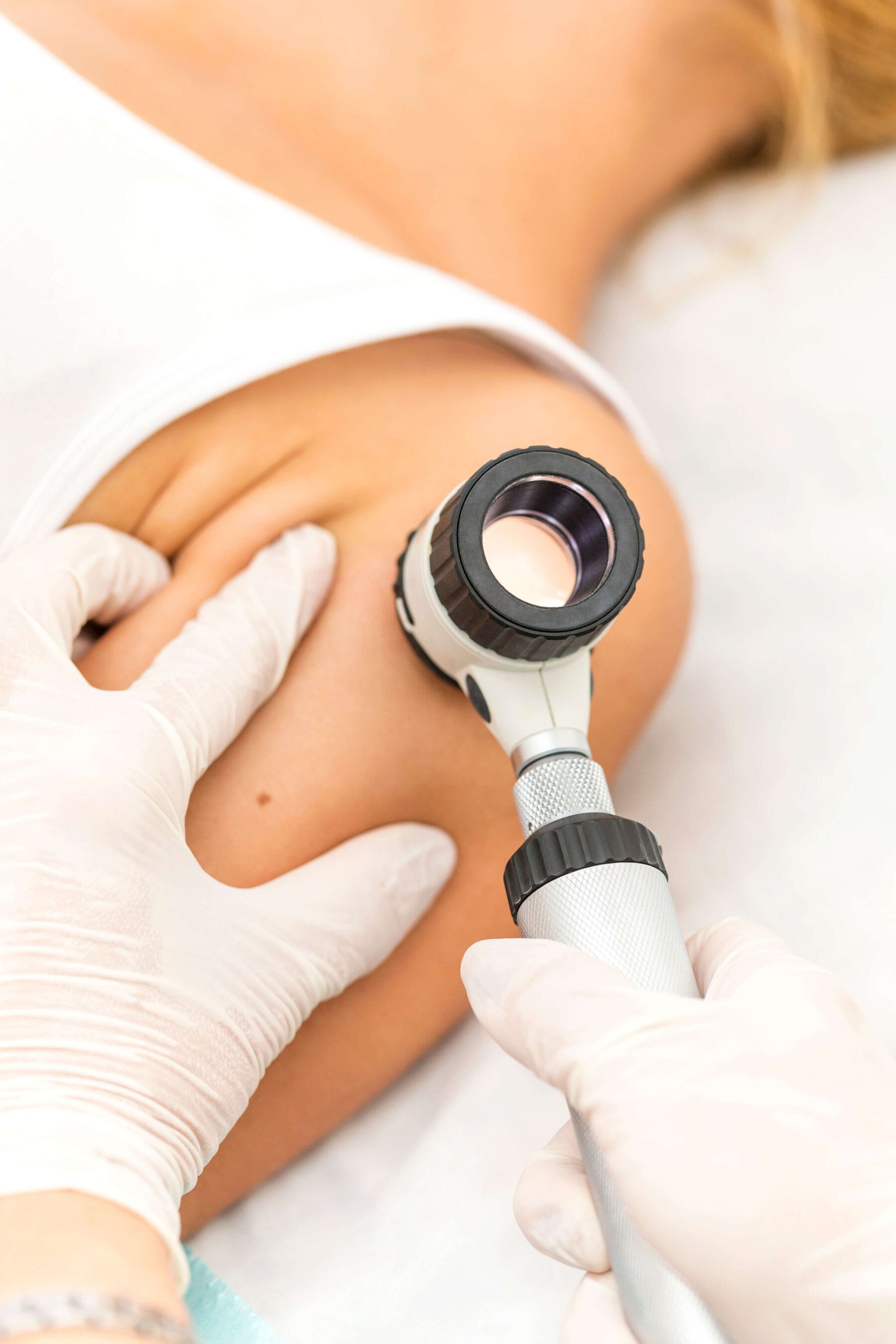 dermatologist-examining-mole-dermatoscope