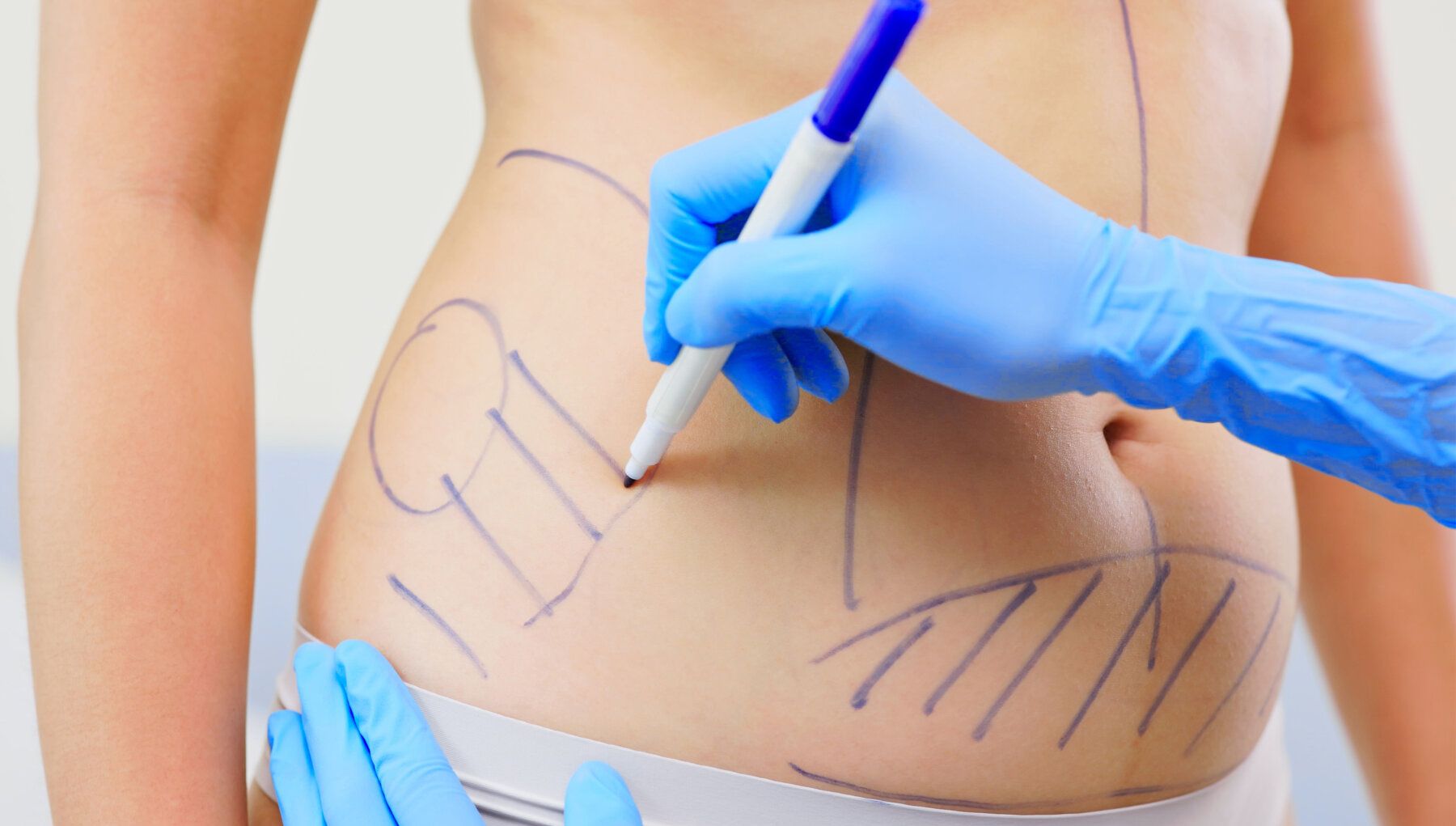 Plastic surgery patient consultation