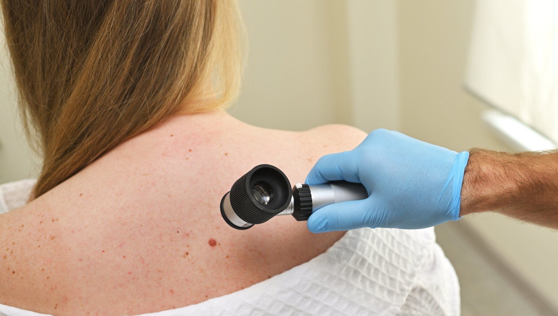 Melanoma