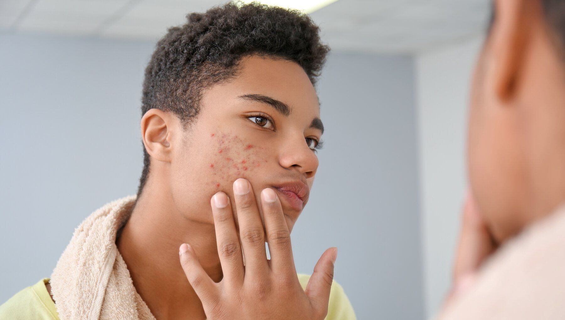 Young man examining his face with acne