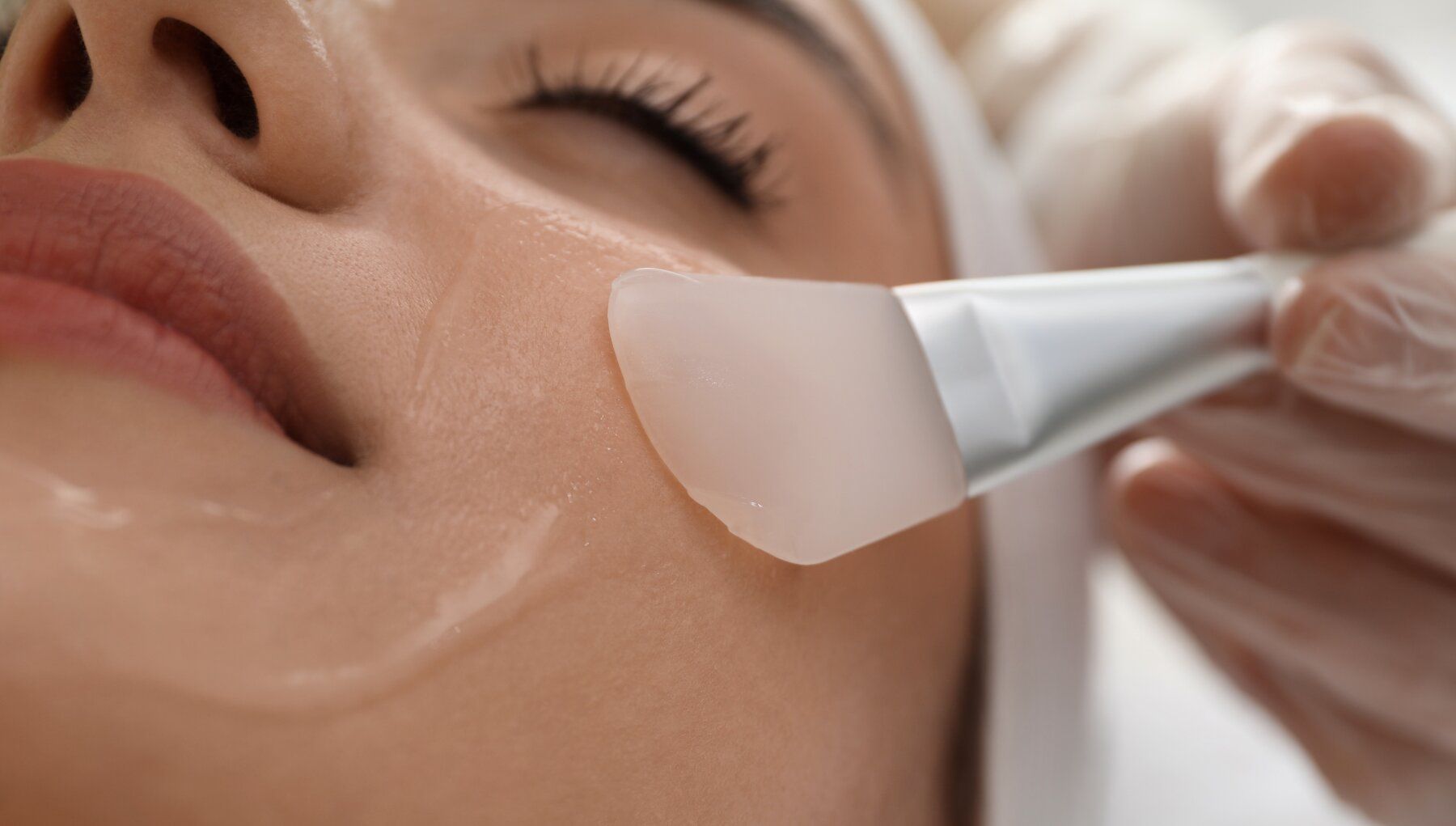 Acne treatment consultation
