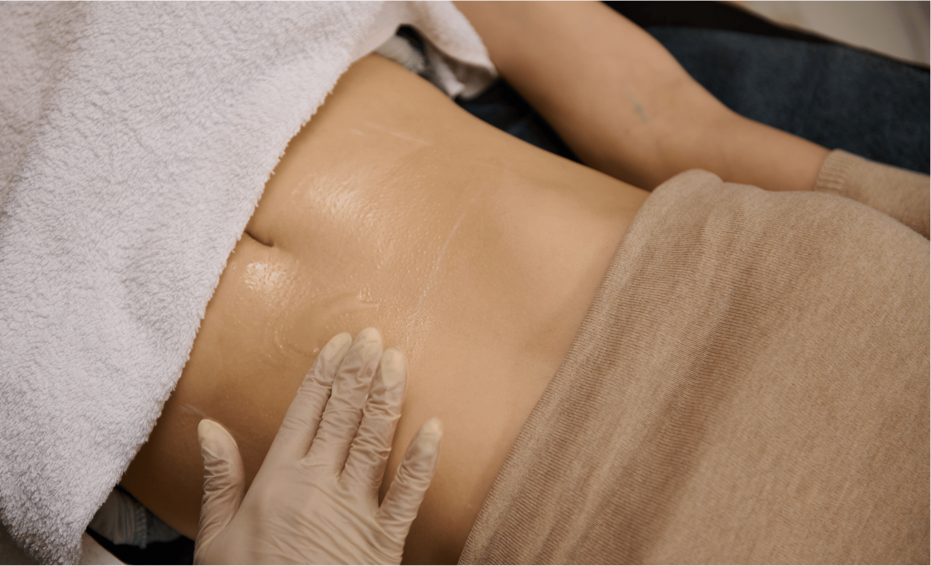 FFD-72358-image-01-EMSCULPT
