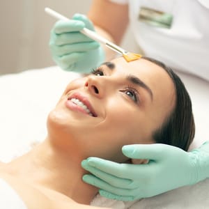 Melasma Peel