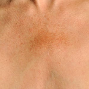 NEOCUTIS