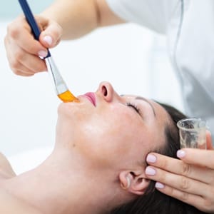 VI® Chemical Peel