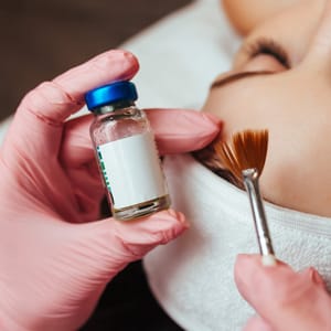 Chemical Peel