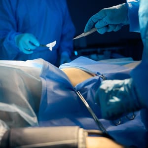 Excisional Surgery