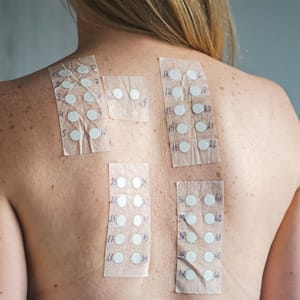 Patch Testing