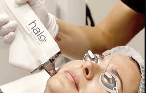 Halo® Laser