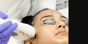 Sciton® MOXI™ Laser